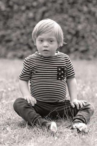 Downs syndrome young boy sitting up, black and white photo.